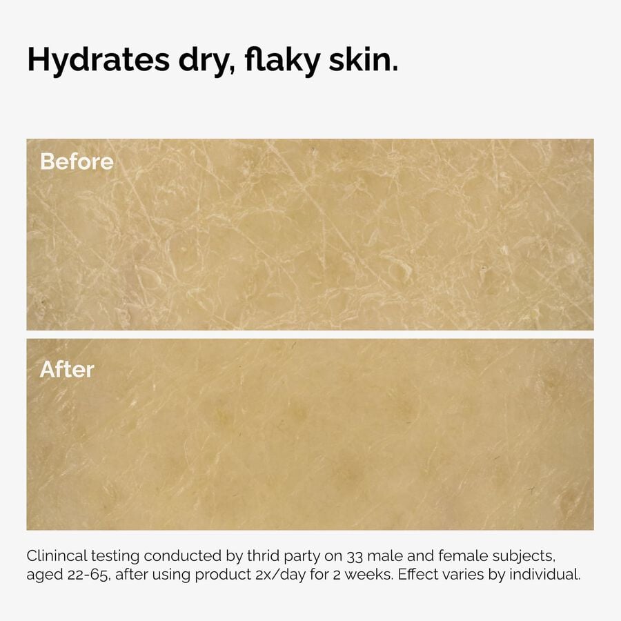 the-body-care-collection-z8 ord-natural-moisturizing-factors-inulin-body-before-after-graphic-02.jpg