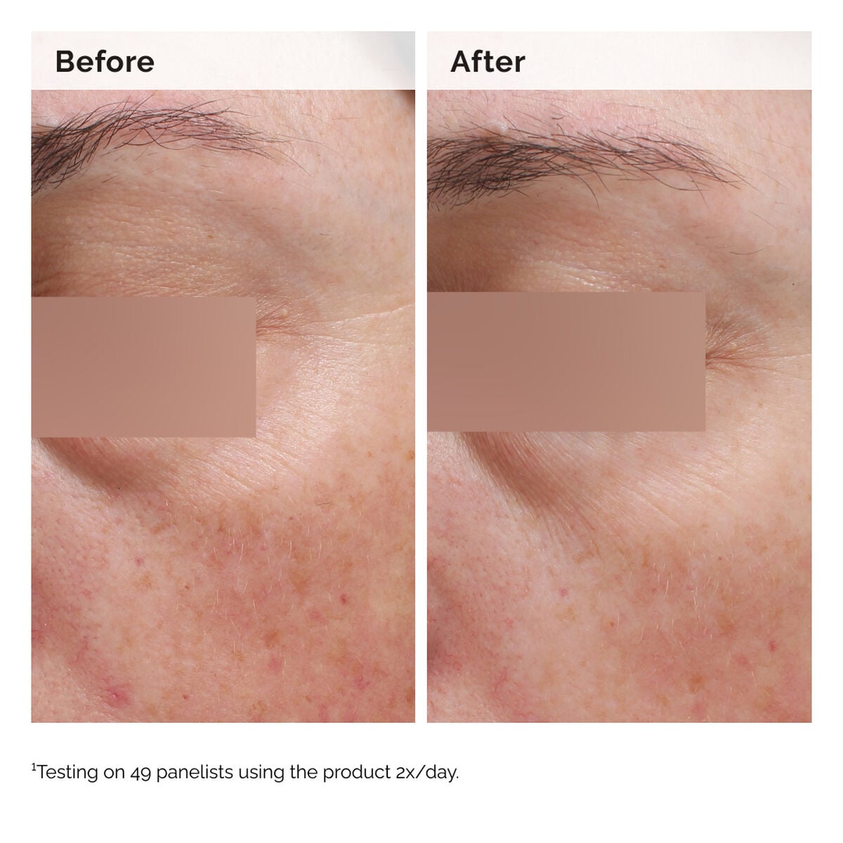 niacinamide-5-face-and-body-emulsion-g9 2024-08-23-ORD-Nia-5pct-Face-Body-B-A-Elasticity-Global-02-1x1.jpg