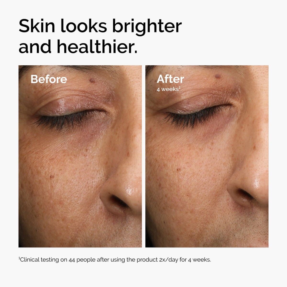 multi-antioxidant-radiance-serum-w4 ord-mars-before-after-healthy.jpg