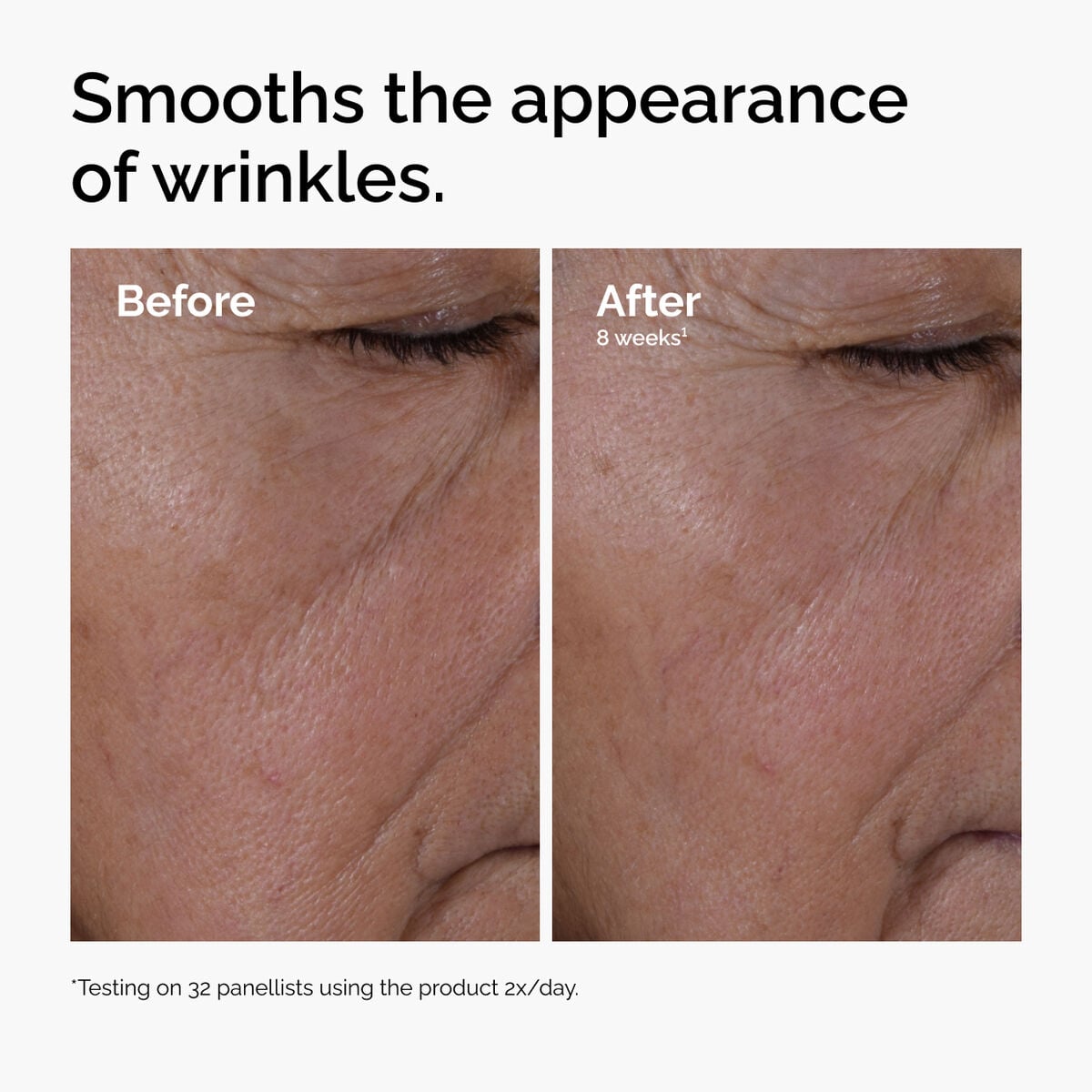 multi-peptide-ha-serum-r8 ord-multi-peptide-ha-serum-wrinkles-before-after.jpg