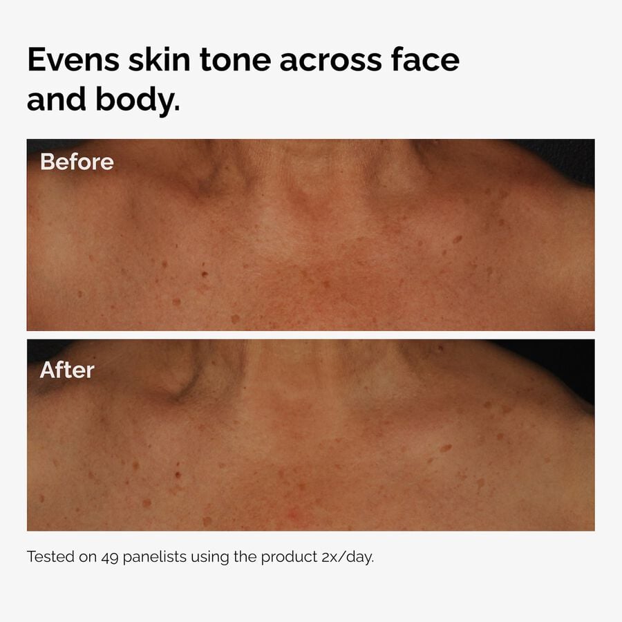 the-body-care-collection-z8 ord-niacinamide-face-body-serum-before-after-even-tone-graphic.jpg