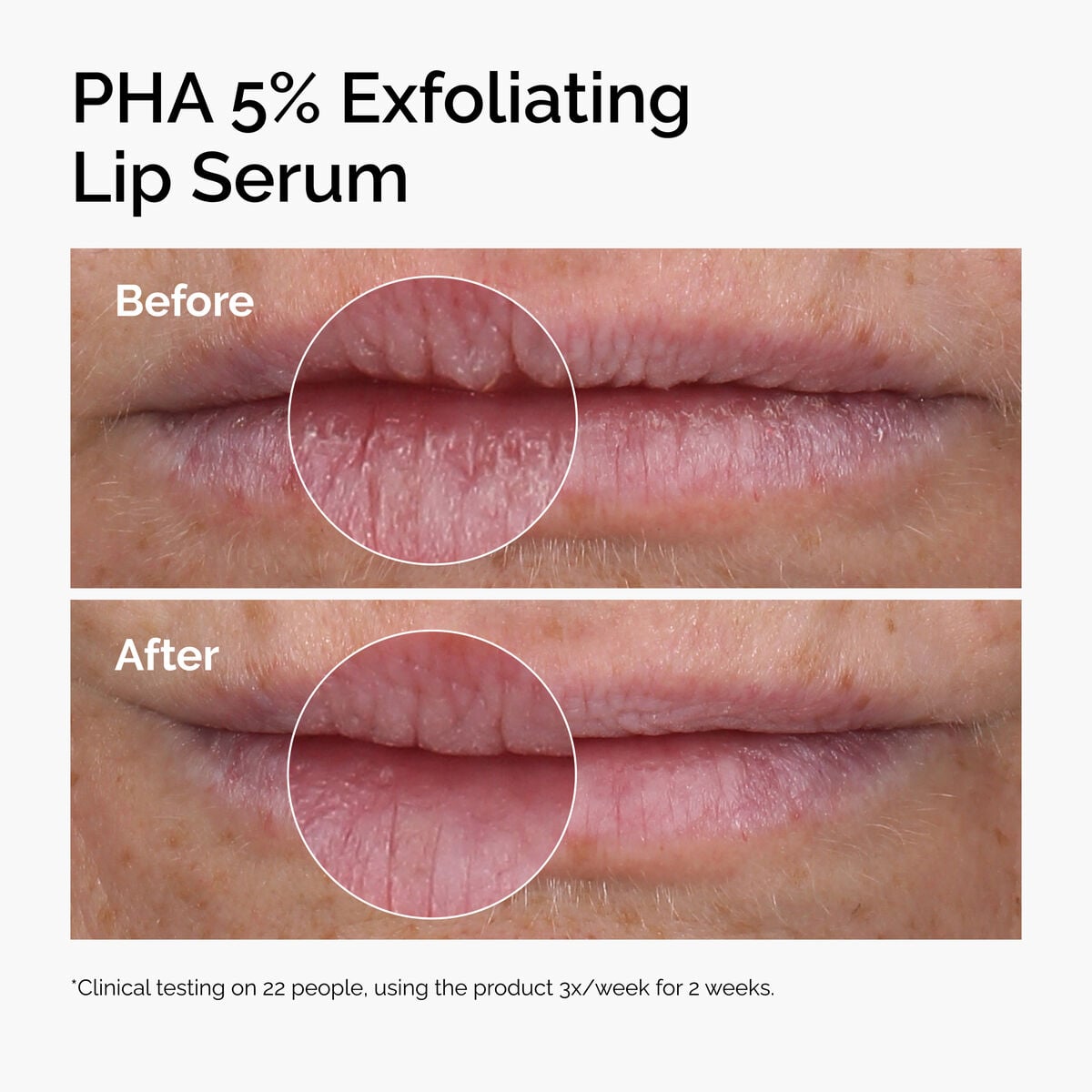 pha-5-exfoliating-lip-serum-e4 ord-pha-5pct-lip-exfoliating-serum-before-after.jpg